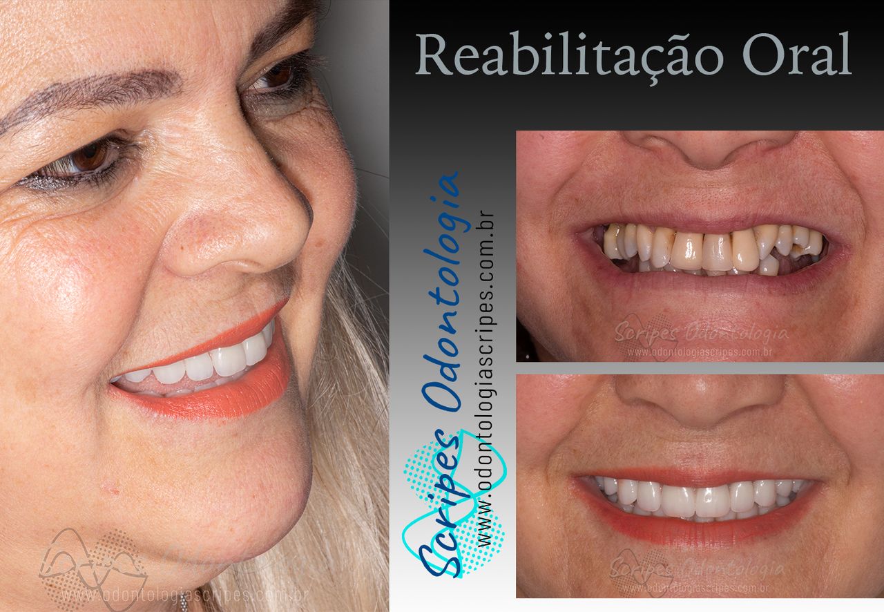 Gabriel Godoy Scripes-70