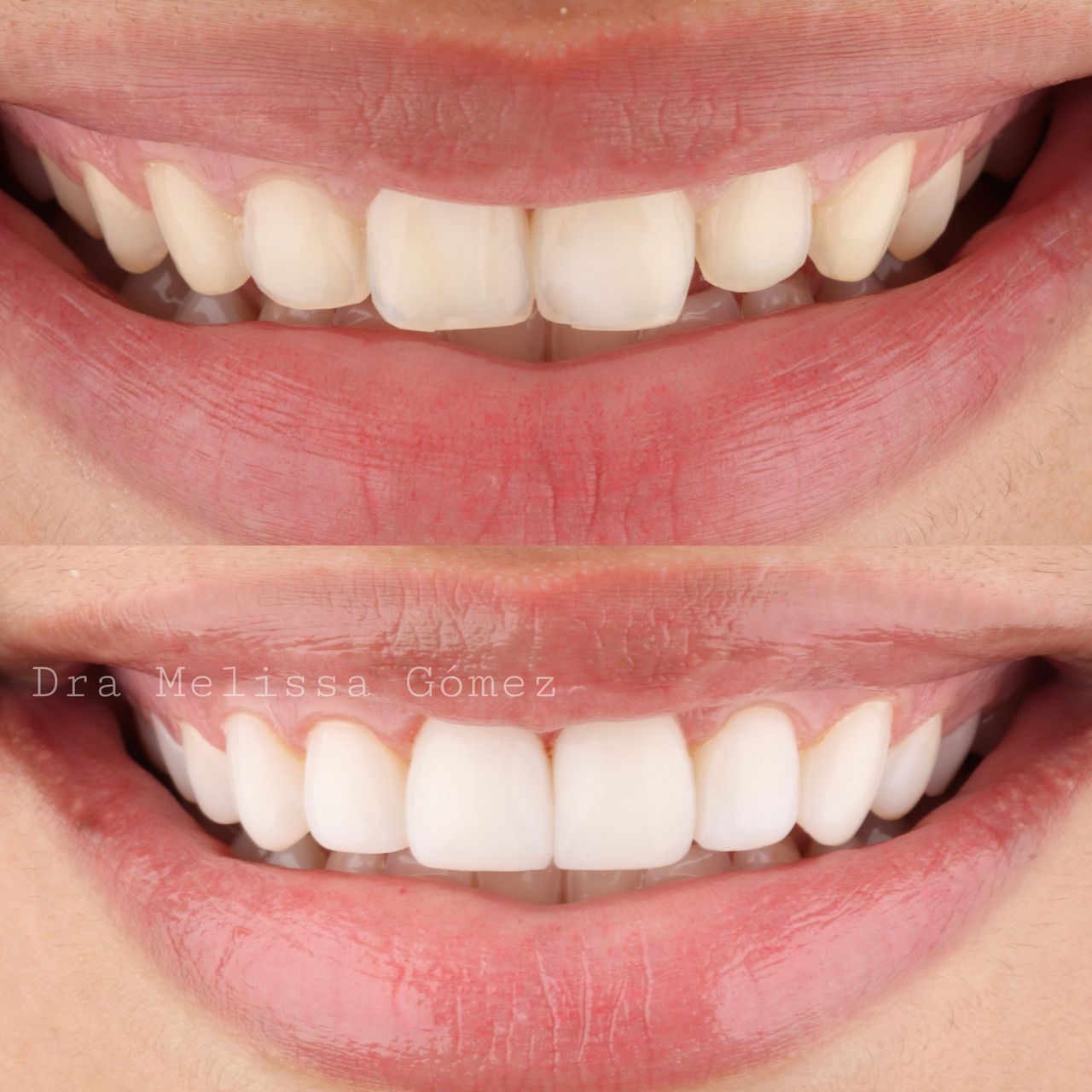 Melissa Gómez Arango-9