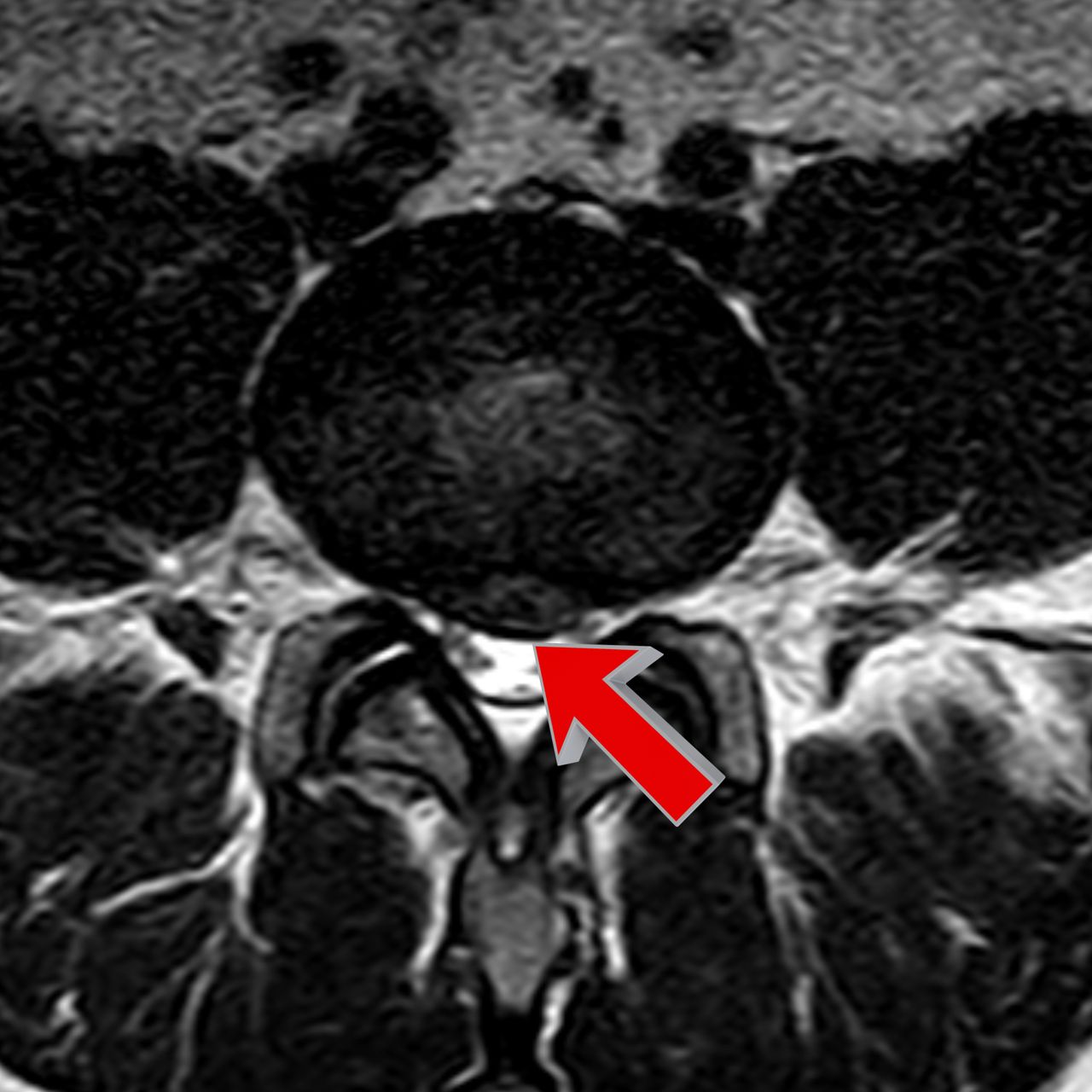 David Tafur Muñoz-2149