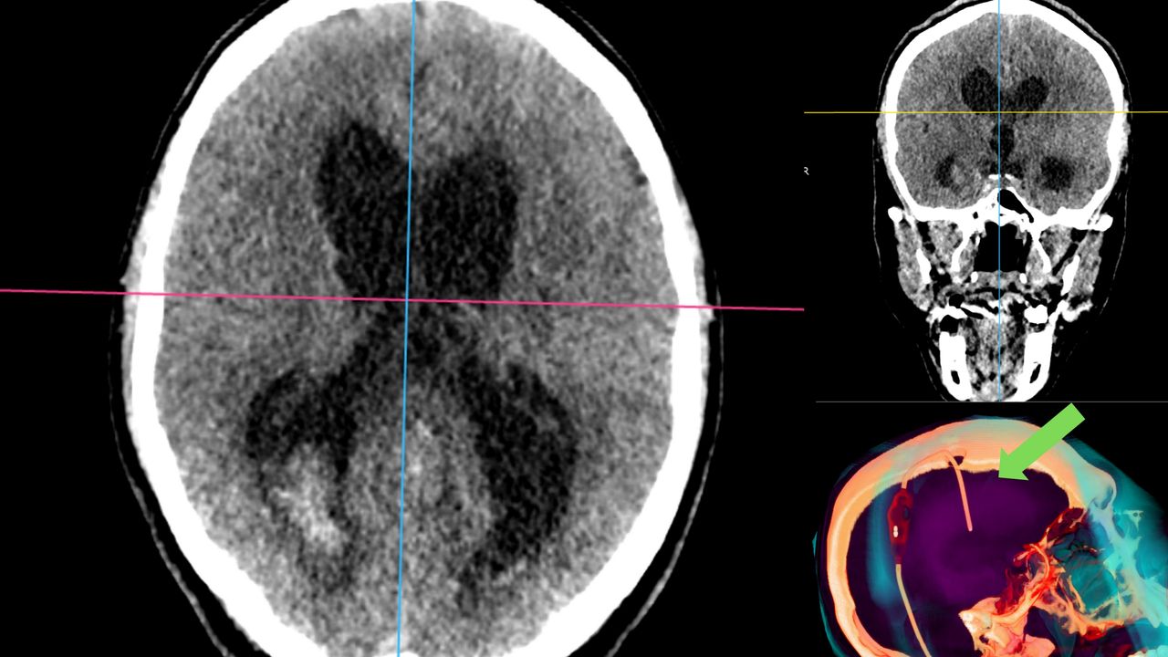 David Tafur Muñoz-2362