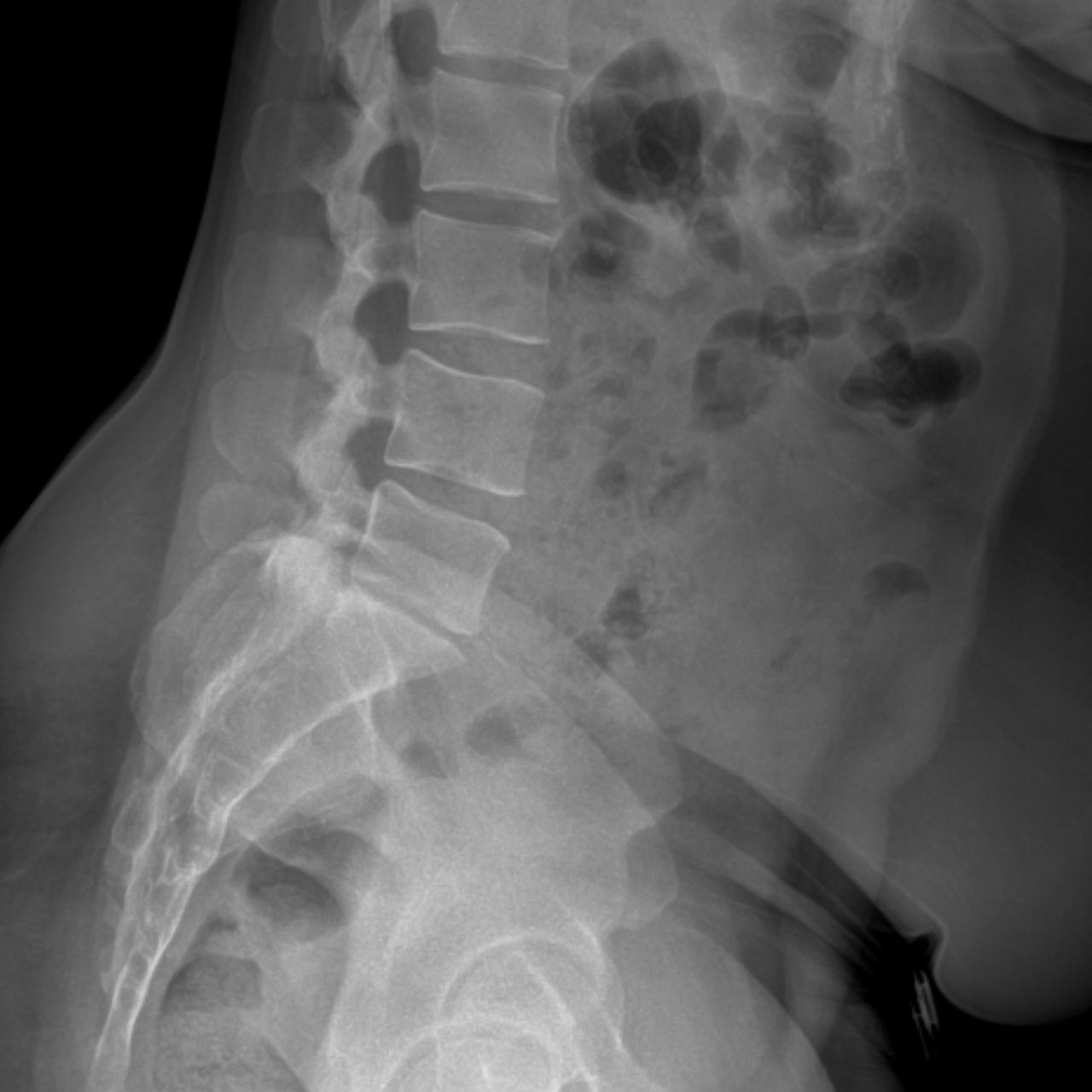 David Tafur Muñoz-2457