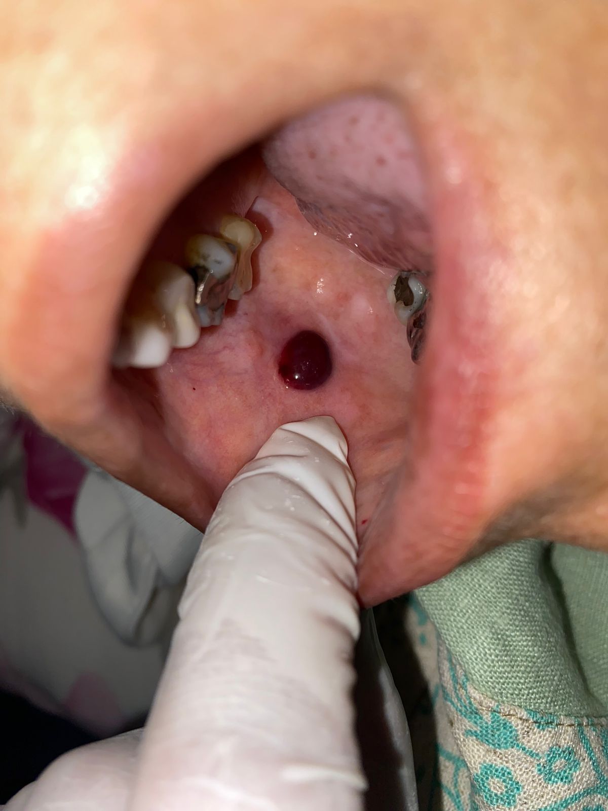 Francisco De Assis Almeida Lima Júnior-29