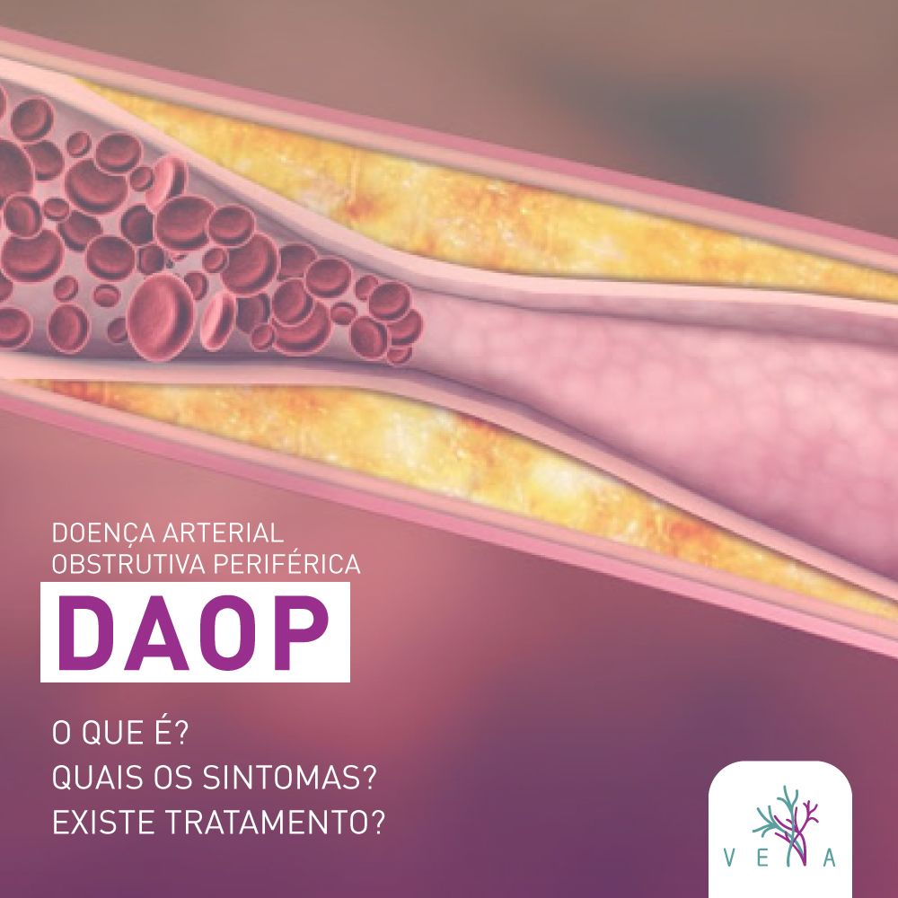 Roberto Scheibler Heck-8