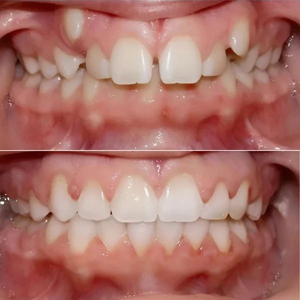 Frank Mendoza Alanya-29