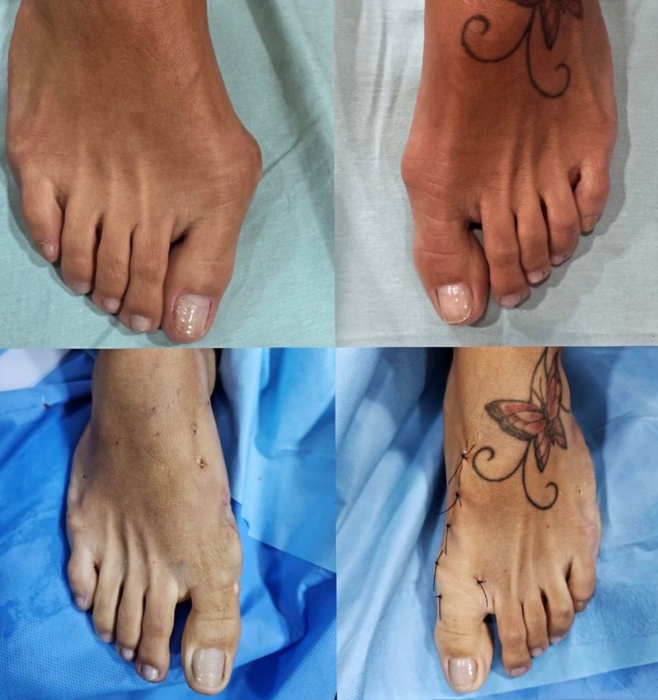 Leandro Jacomassi Machado-12