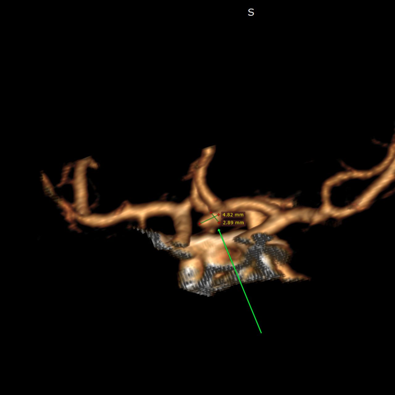 David Tafur Muñoz-2173