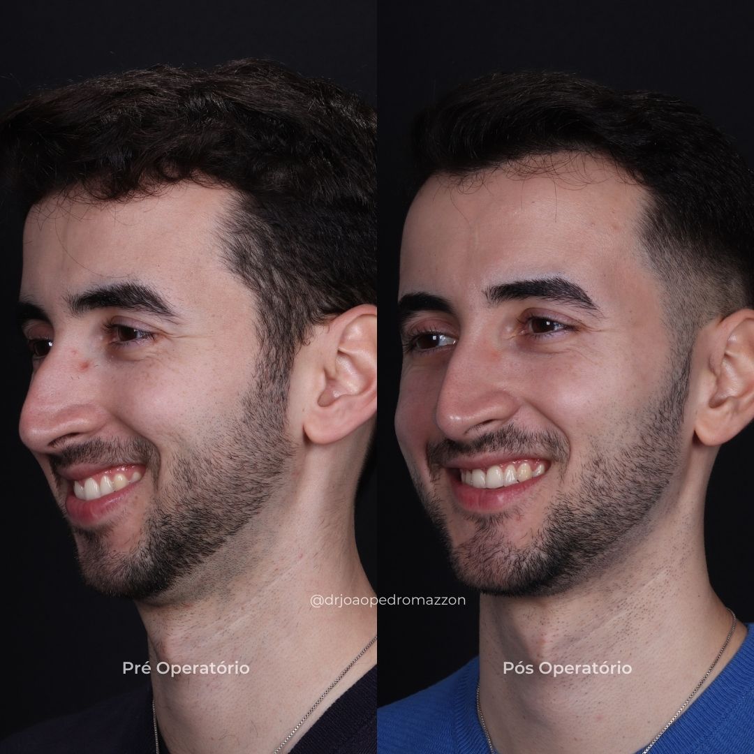 João Pedro Paulino Mazzon-75