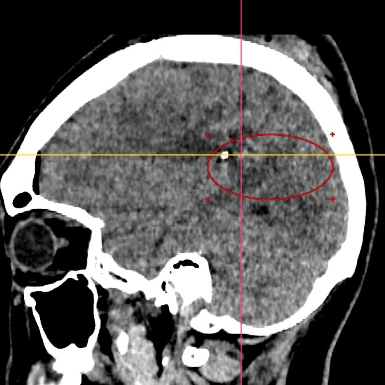 David Tafur Muñoz-1395