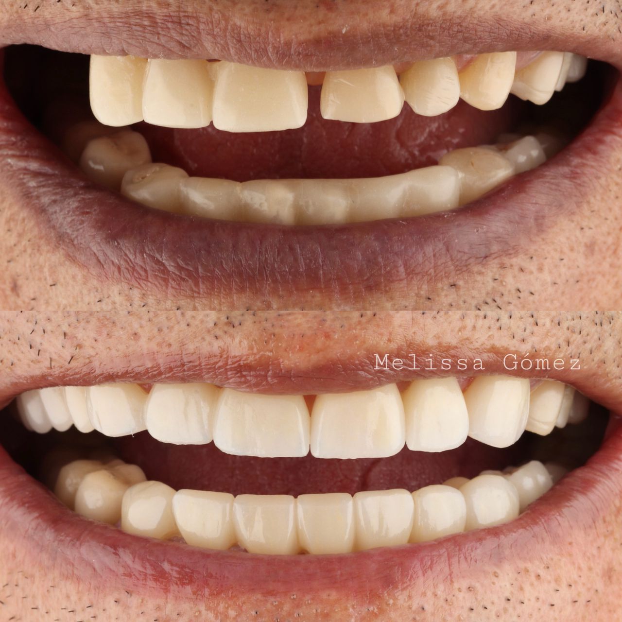 Melissa Gómez Arango-16