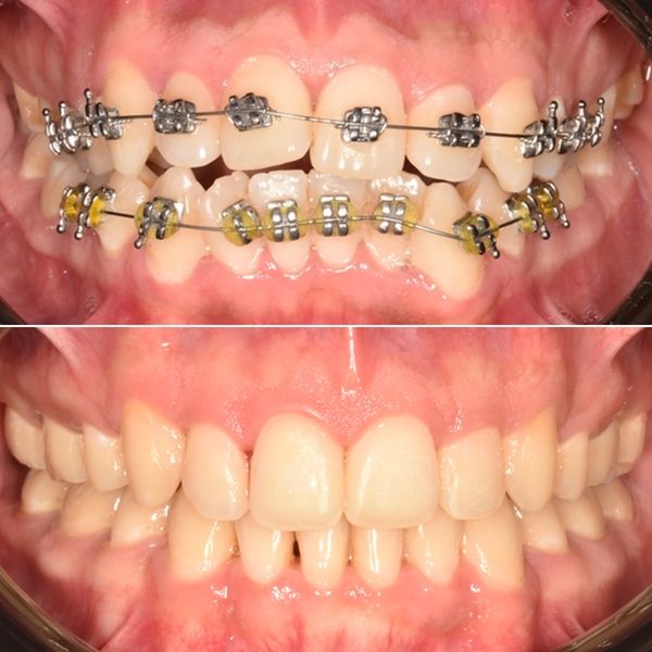 Frank Mendoza Alanya-22