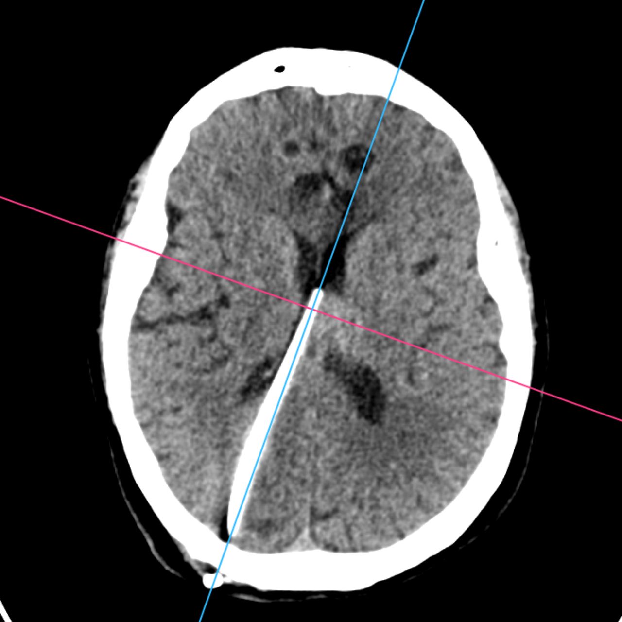 David Tafur Muñoz-1893