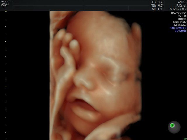 Raul Javier Banderas Pumarino-26