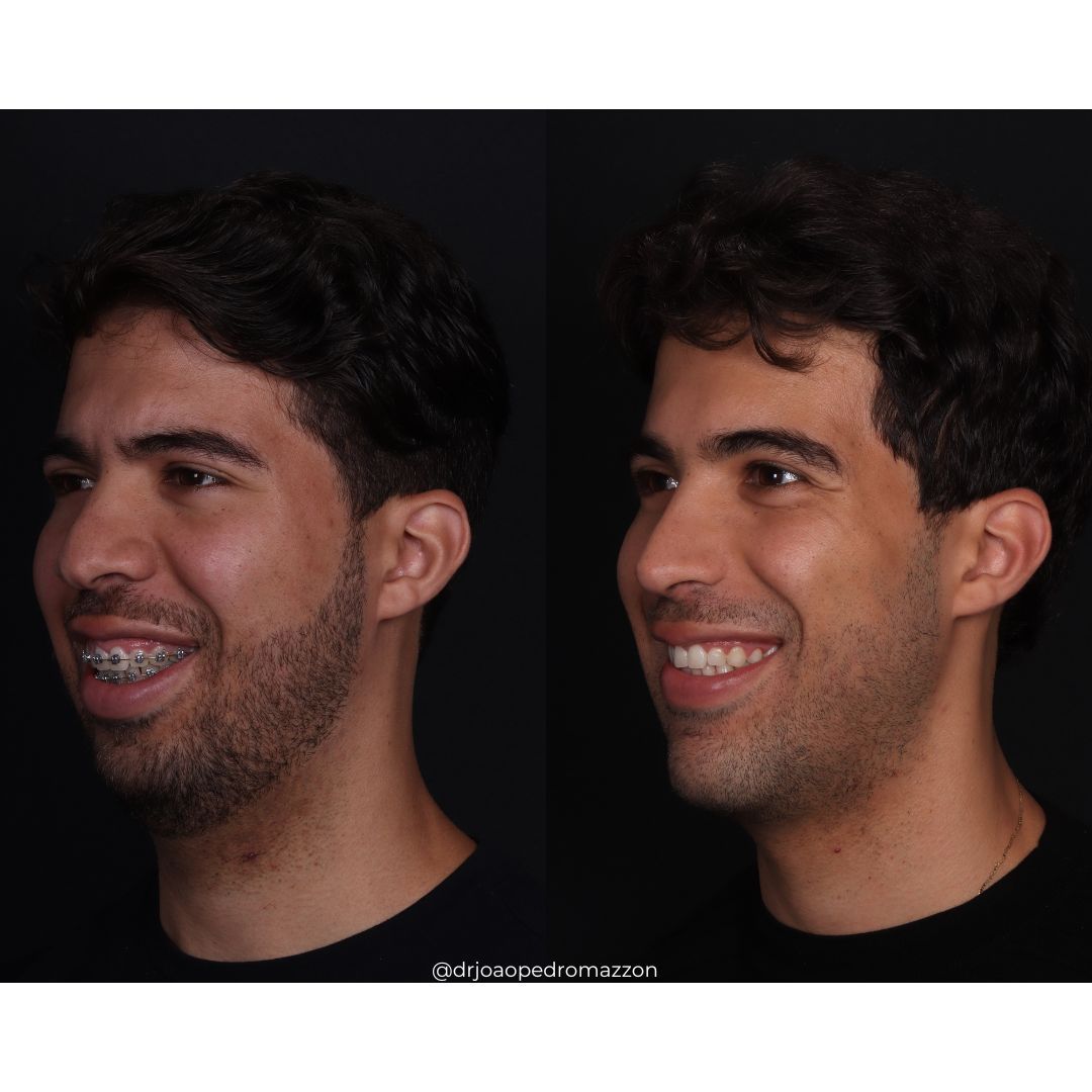 João Pedro Paulino Mazzon-45