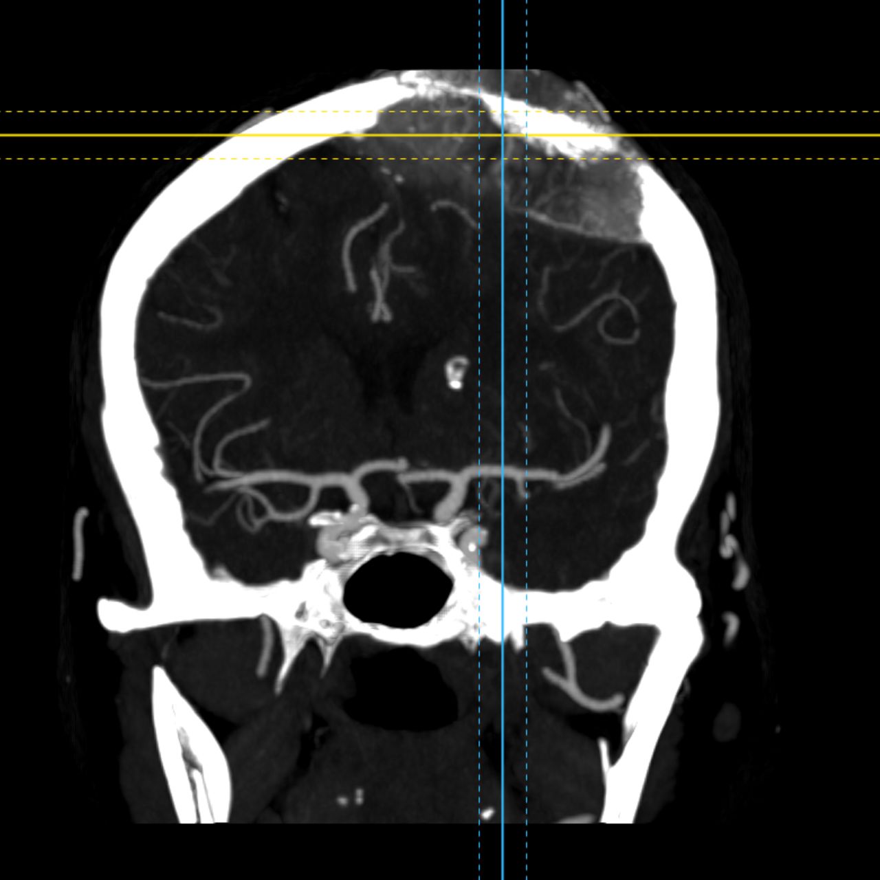 David Tafur Muñoz-2100
