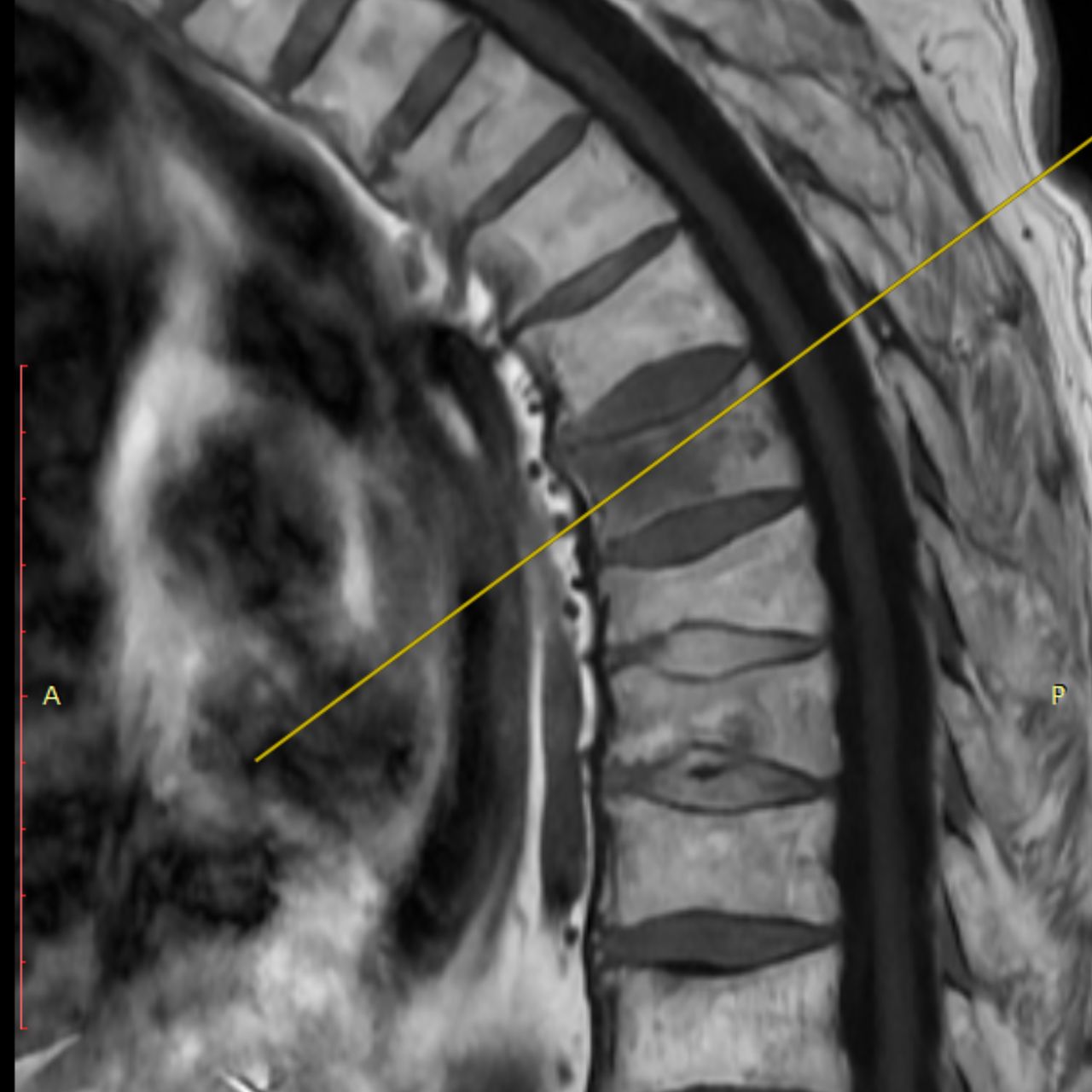 David Tafur Muñoz-1476