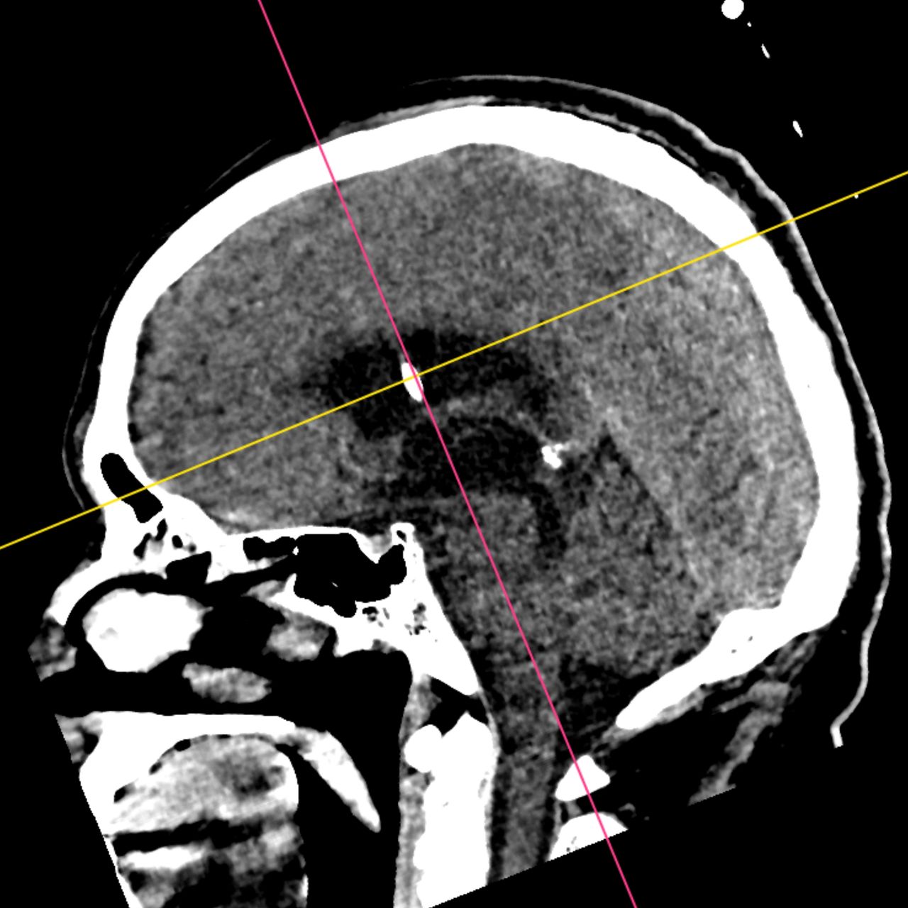 David Tafur Muñoz-2397