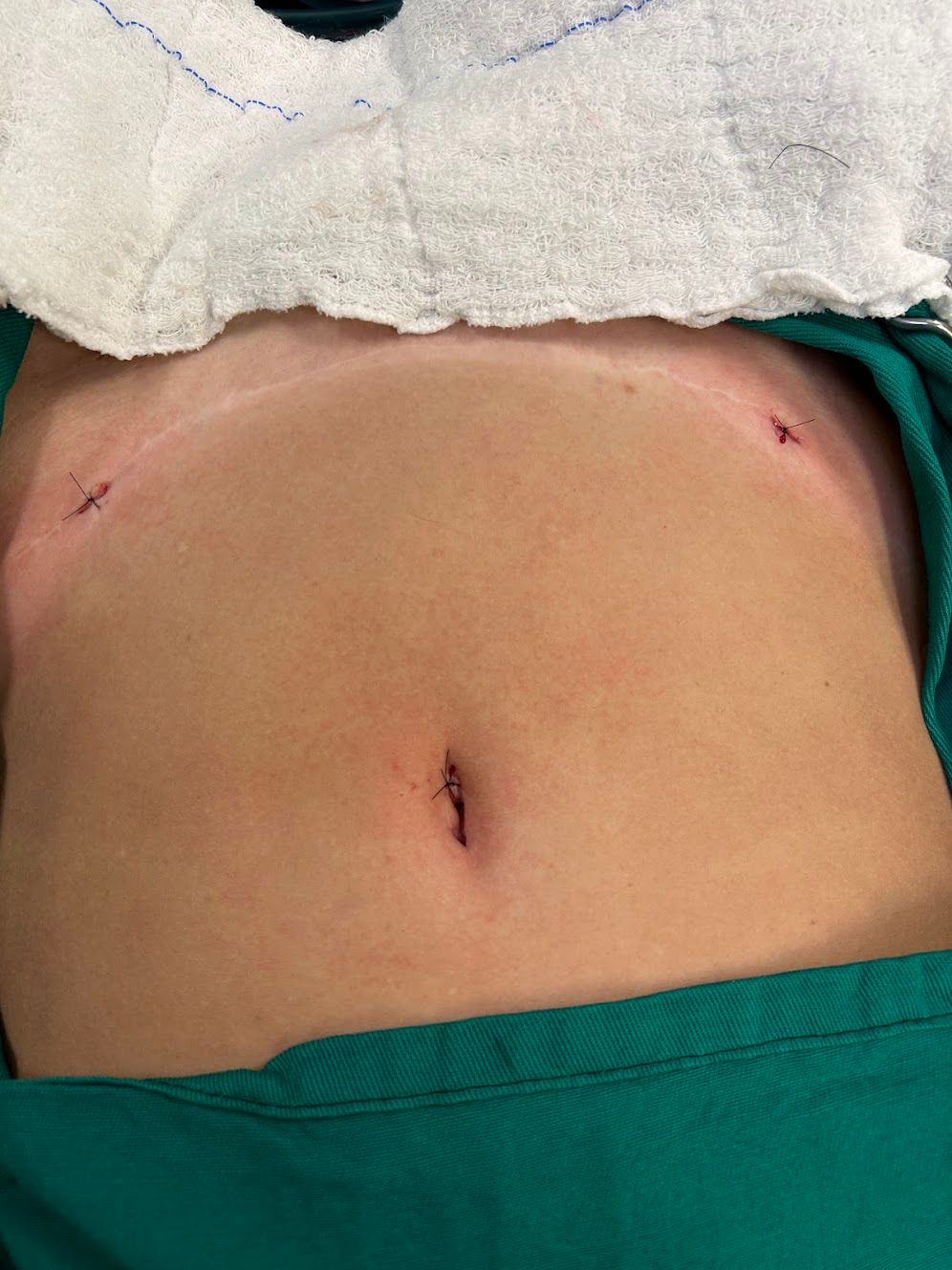 Adalberto Cesario Pereira Junior-41