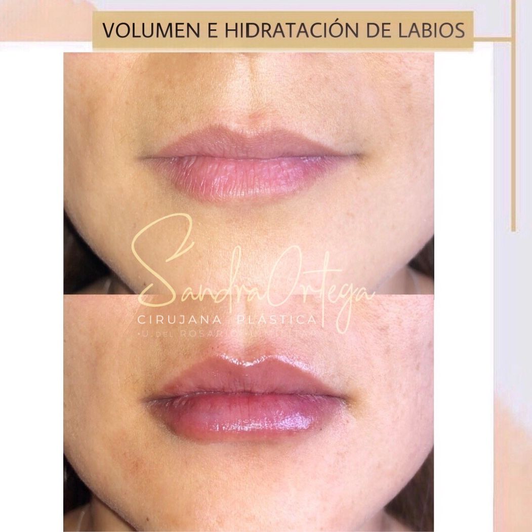 Sandra Viviana Ortega Trejos-10