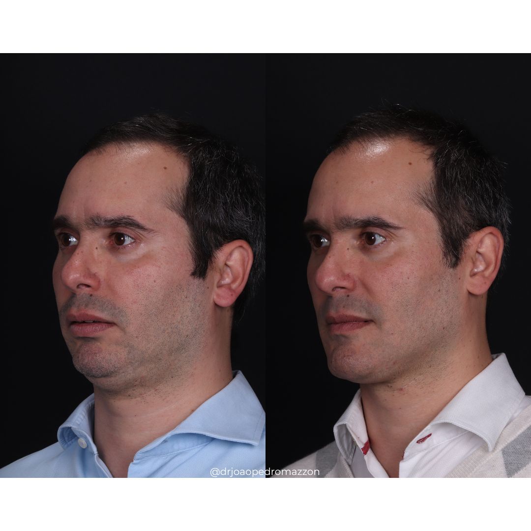 João Pedro Paulino Mazzon-52