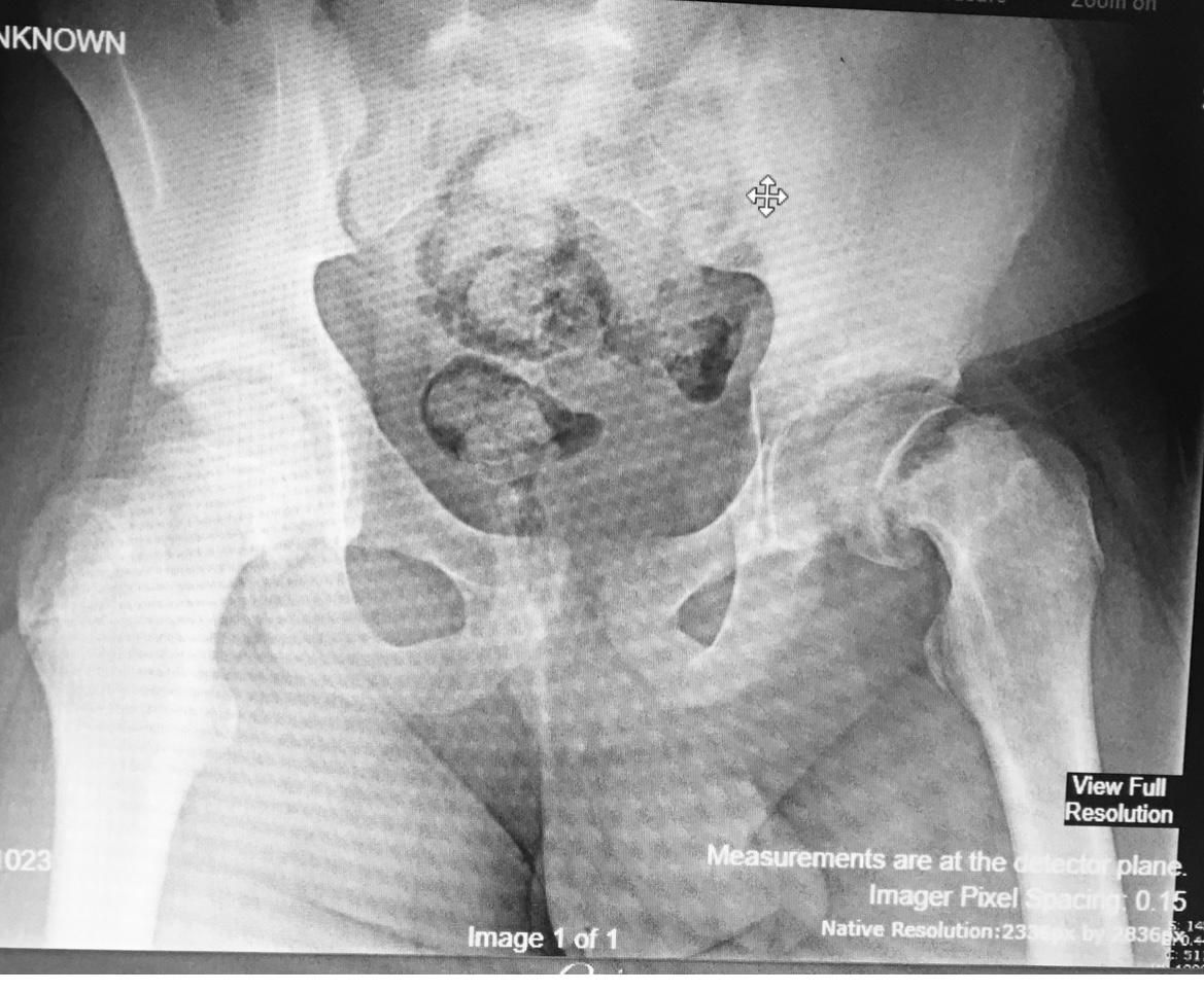 Jônatas Laurindo Giacomini-16