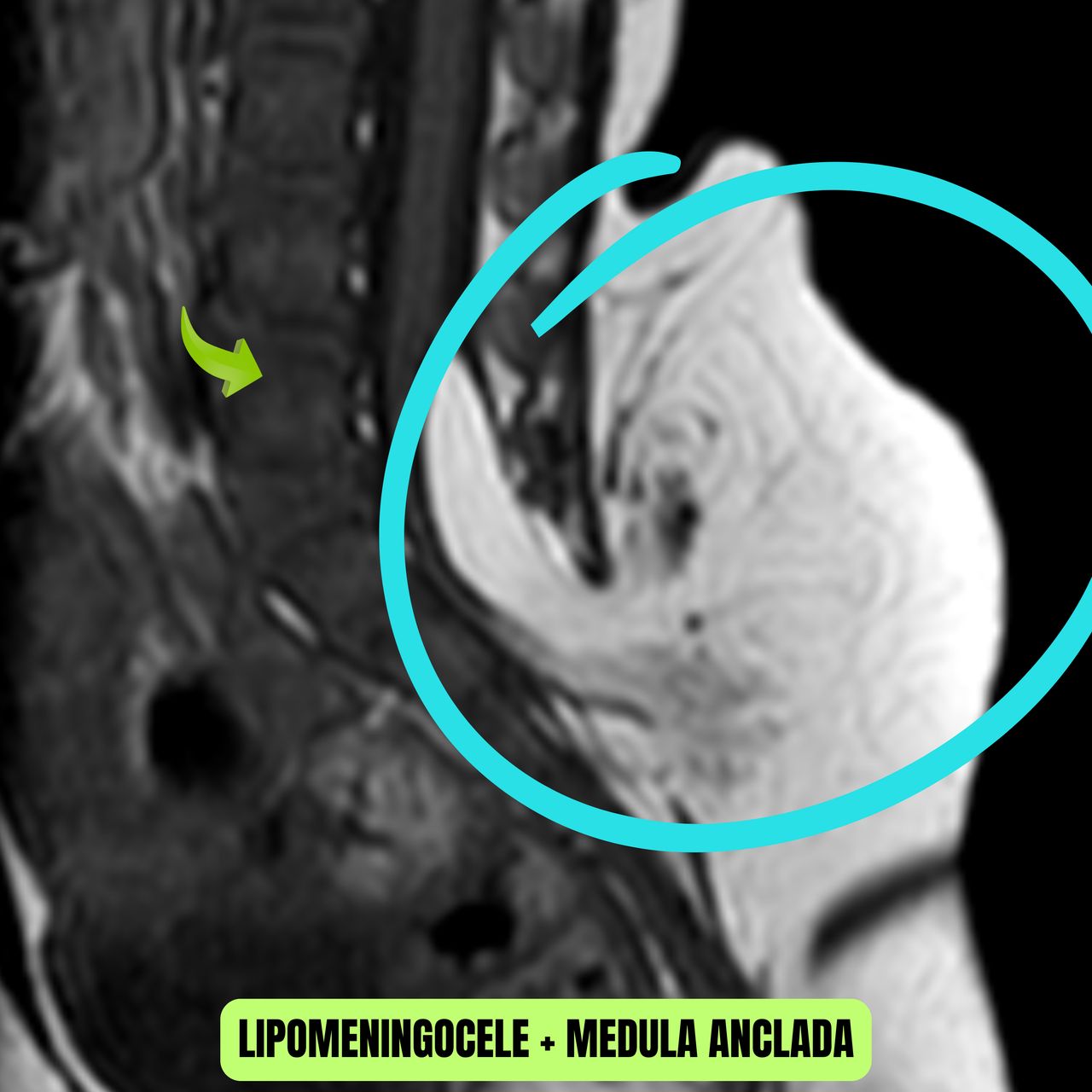 David Tafur Muñoz-1037