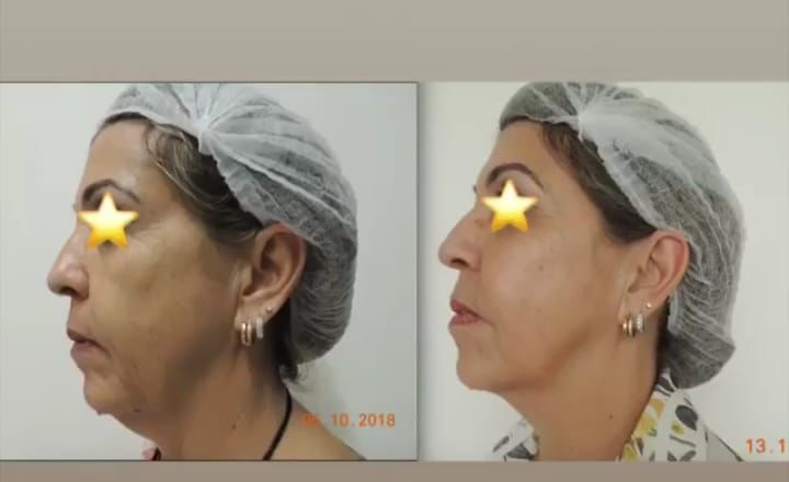 Bruna Salerno-4