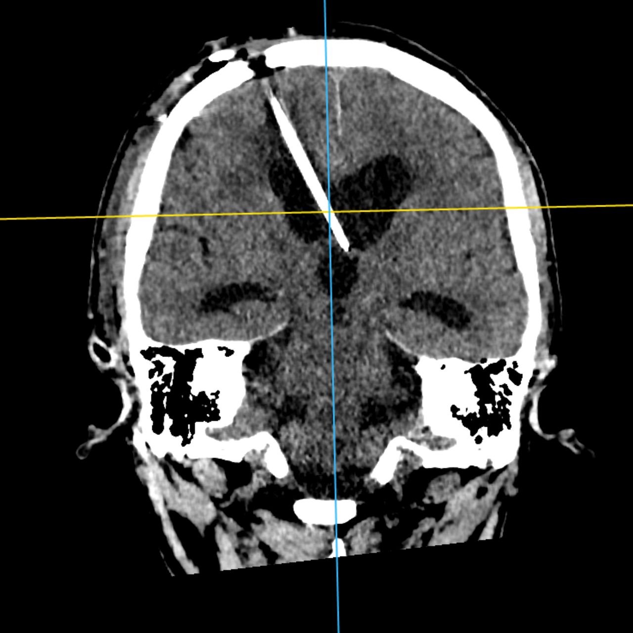David Tafur Muñoz-2401