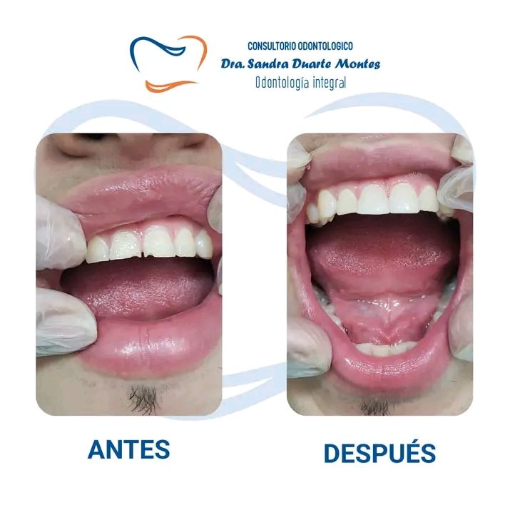 Sandra Duarte Montes-5