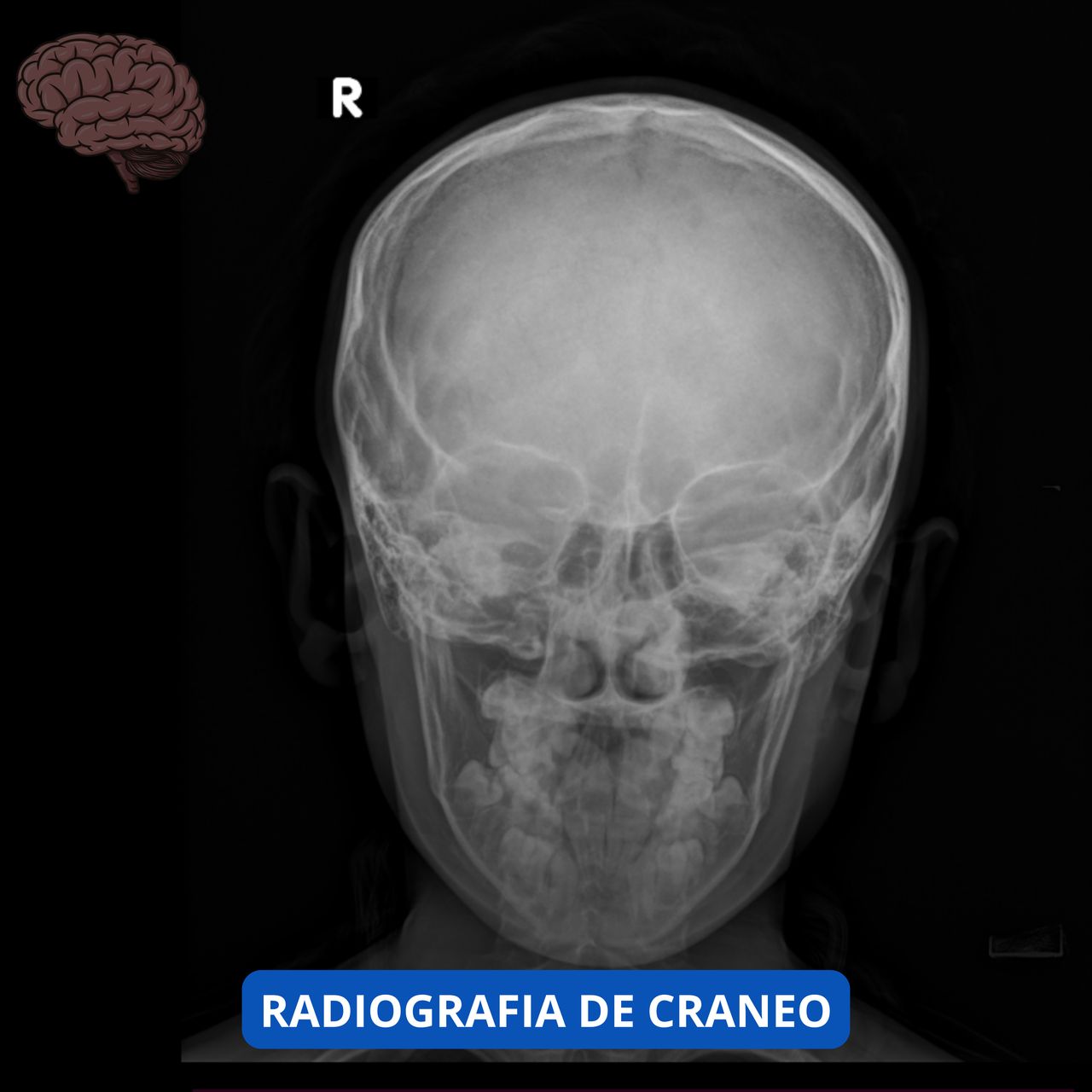 David Tafur Muñoz-1923