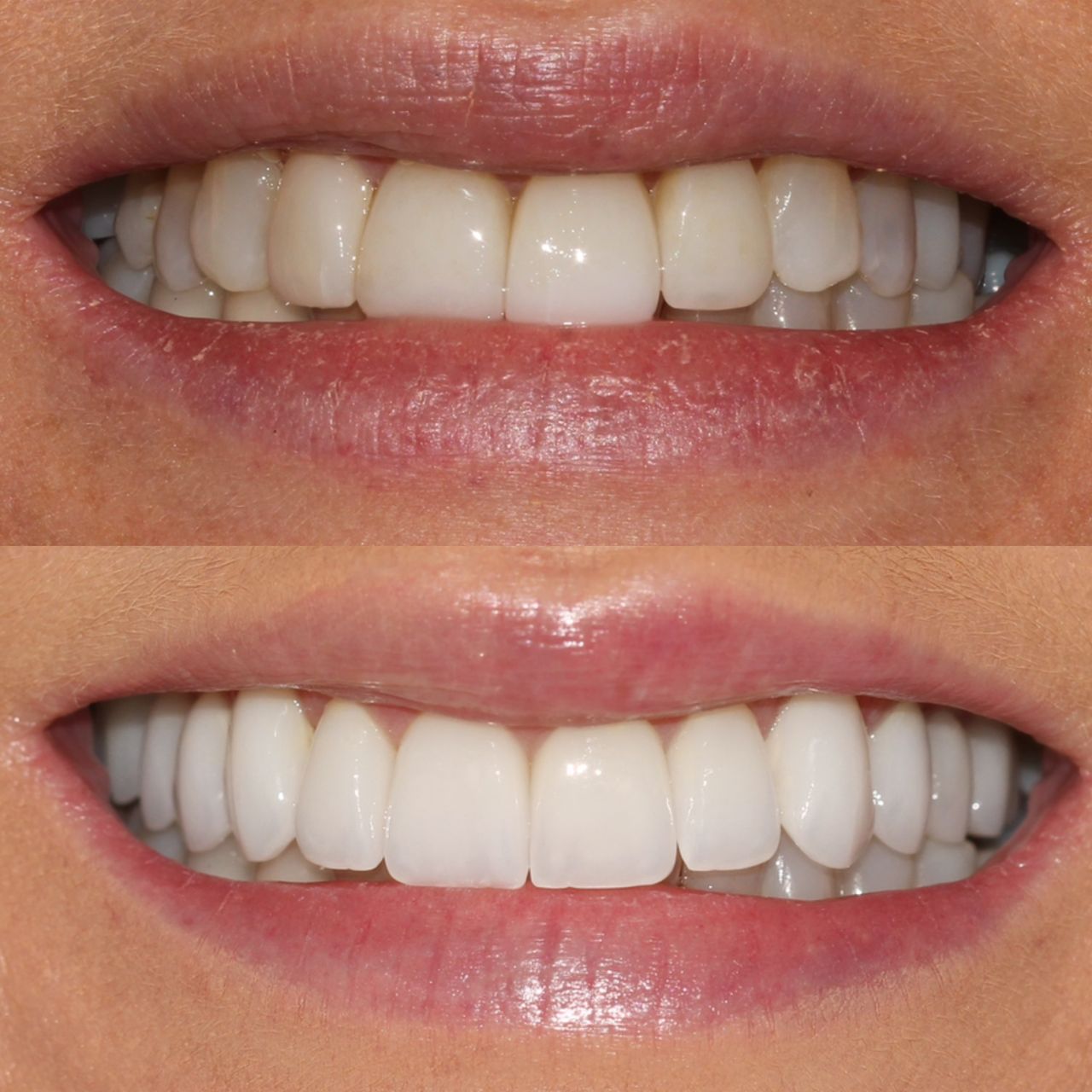 Caroline Benedeti-31