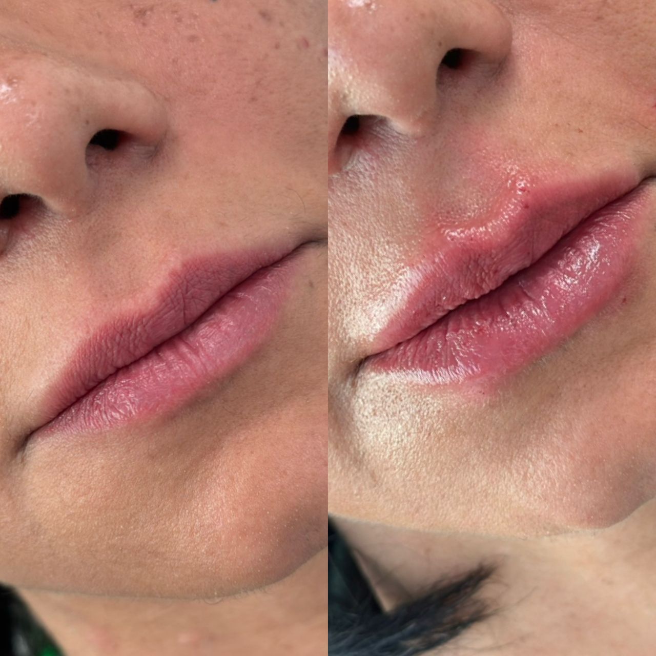 Caroline Benedeti-46