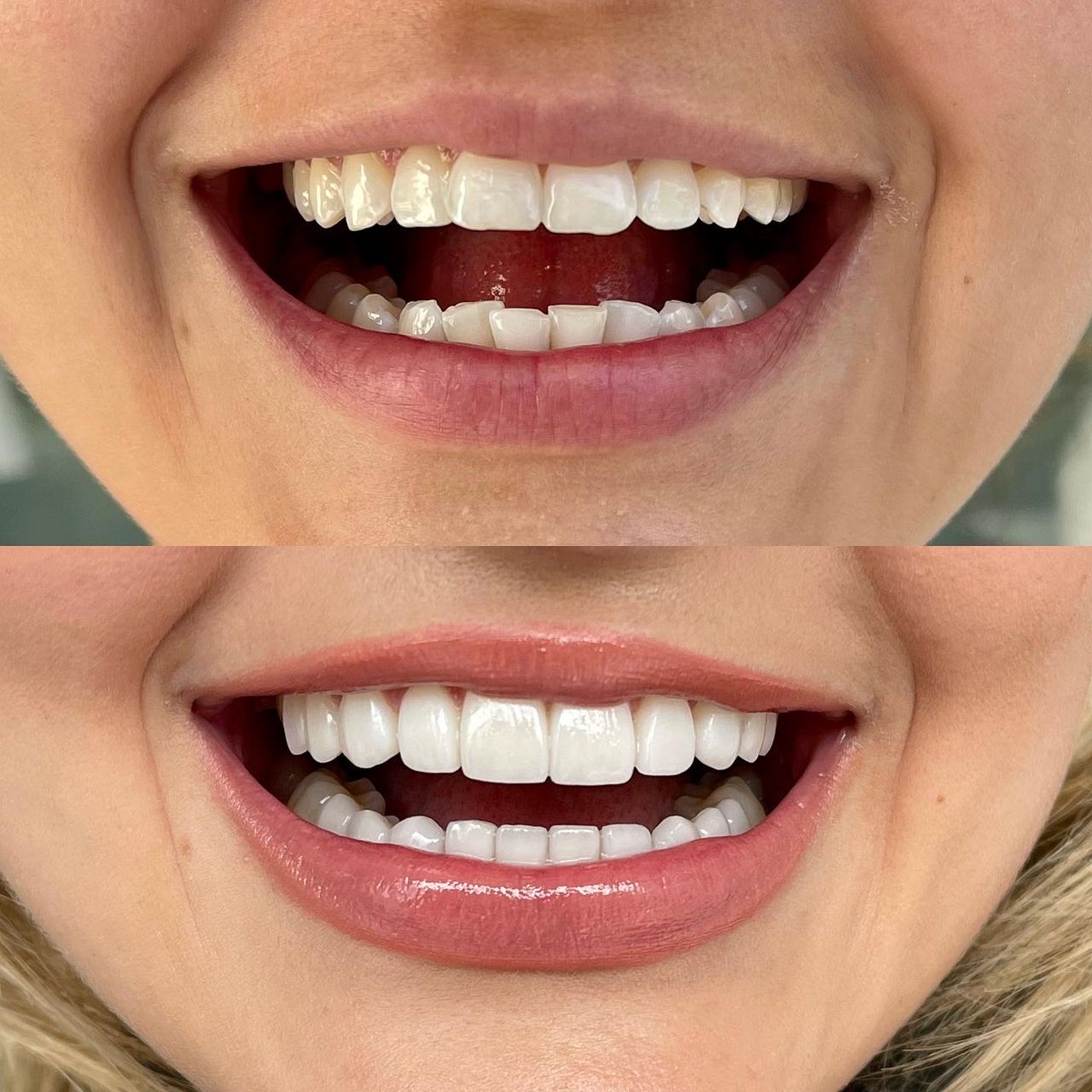 Franci Yulied López Jiménez-11