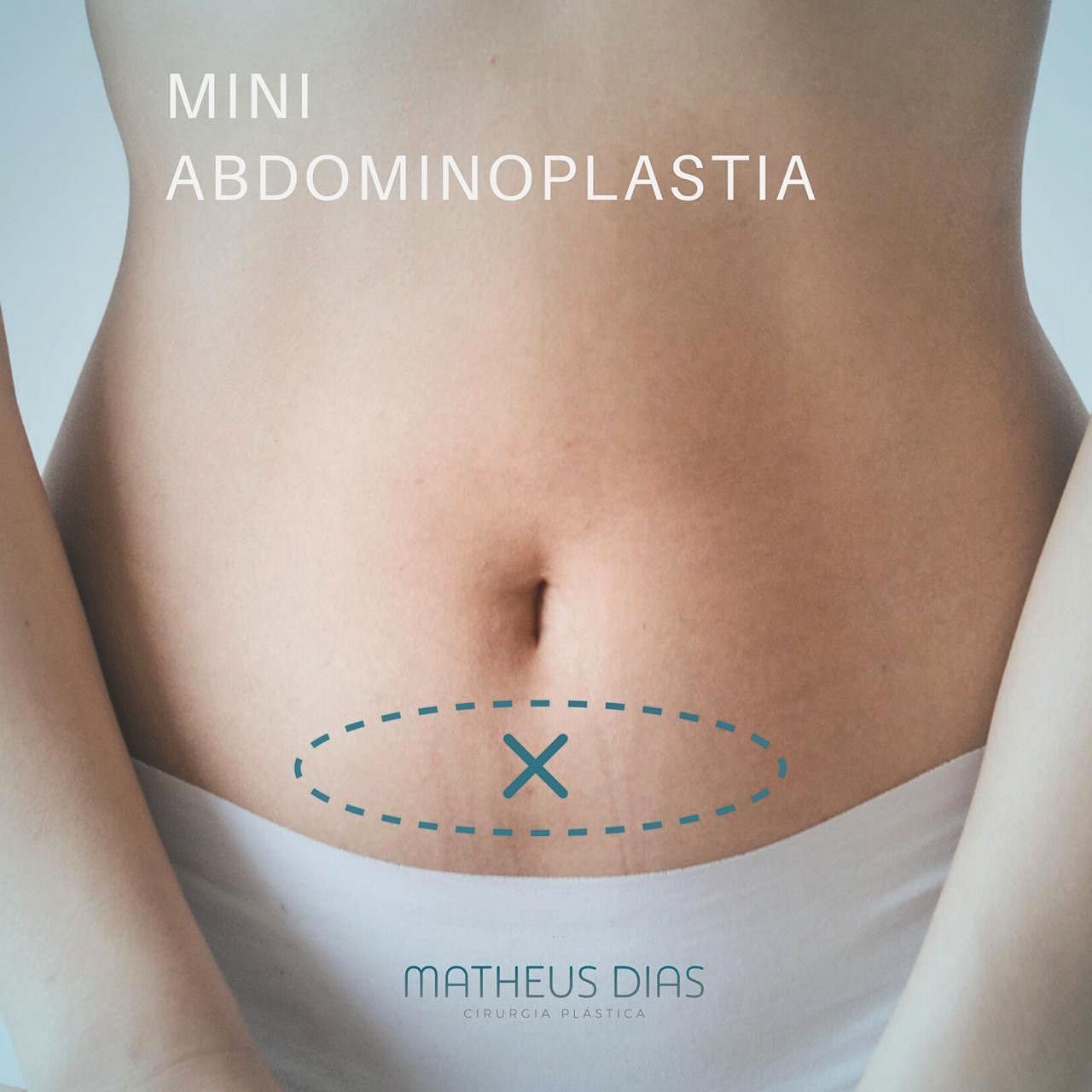 Matheus Dias Araujo-5