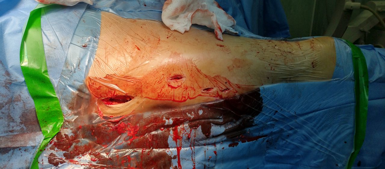 Carlos Escalante Saavedra-13