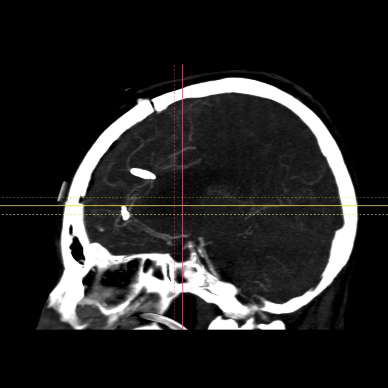 David Tafur Muñoz-1776