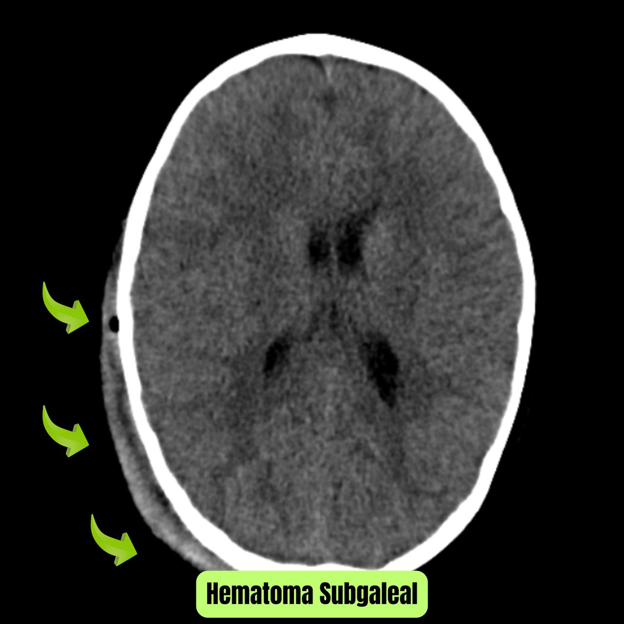 David Tafur Muñoz-1997