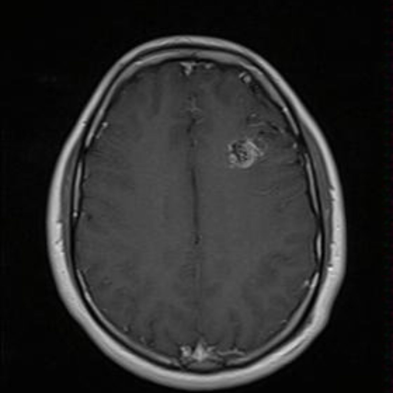 David Tafur Muñoz-2124