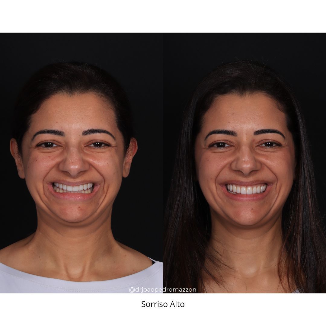 João Pedro Paulino Mazzon-5