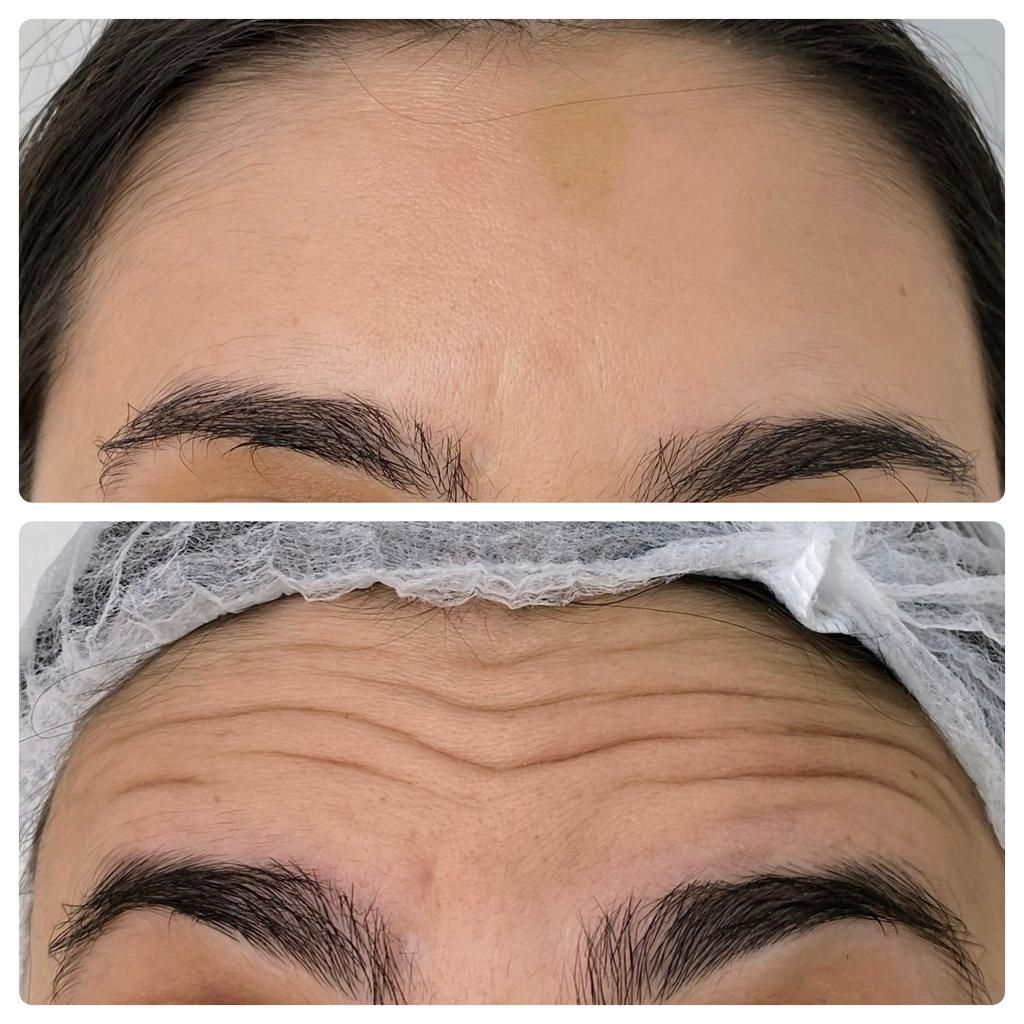 Luiz Antonio Da Silva-11