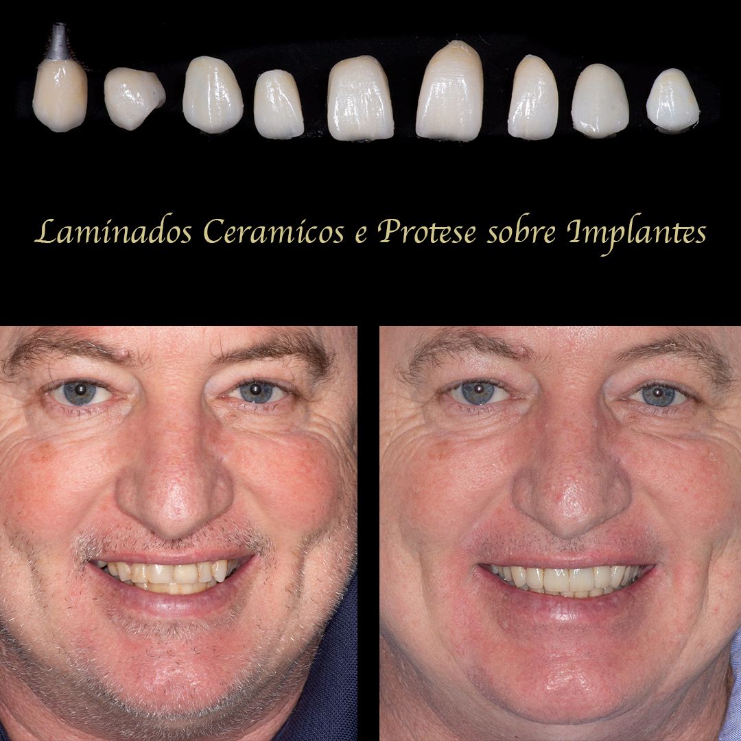 Gabriel Godoy Scripes-76