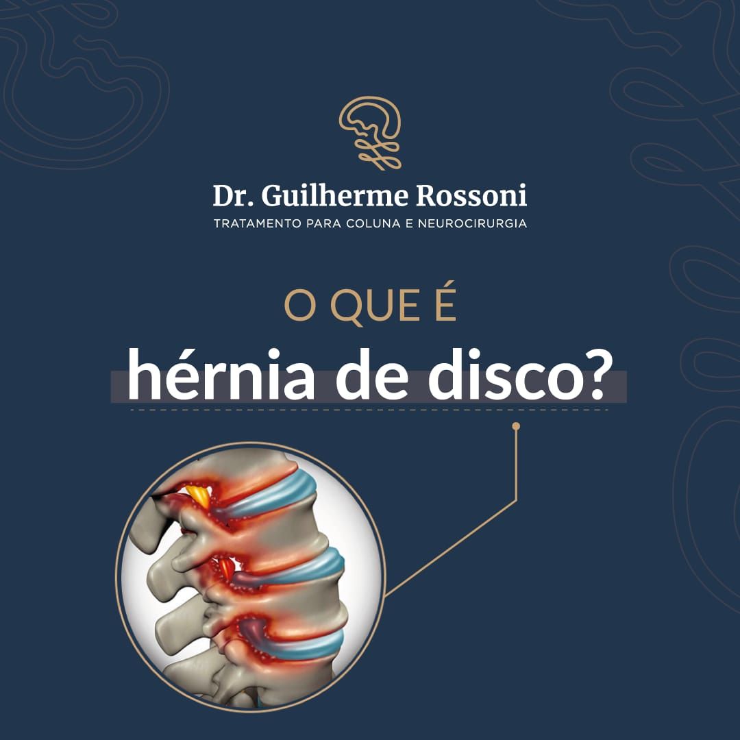 Guilherme Rossoni-15