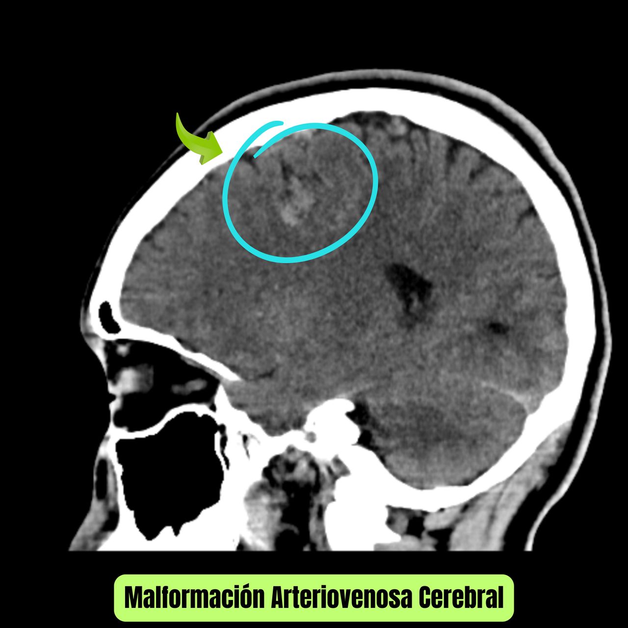 David Tafur Muñoz-2006