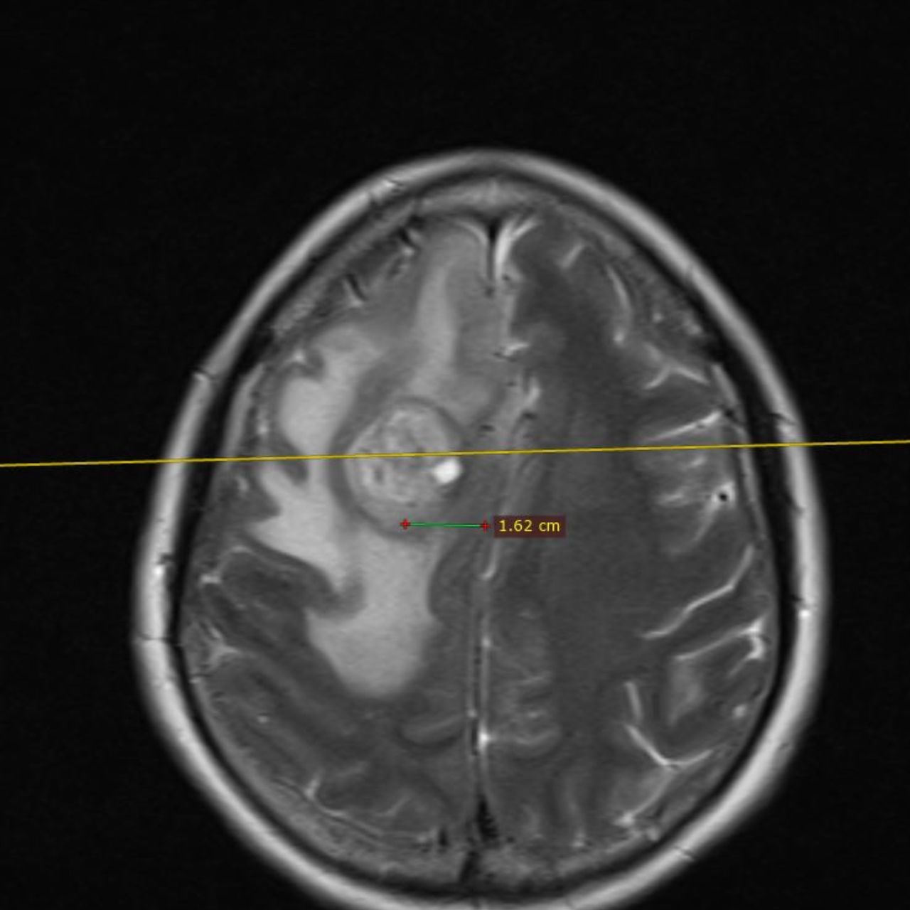 David Tafur Muñoz-1797