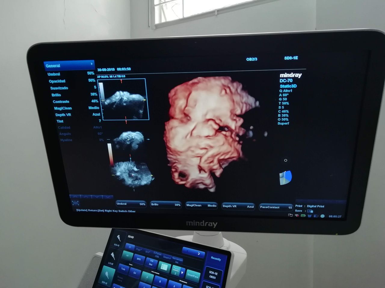 David Stivel Pinzón Garcia-4