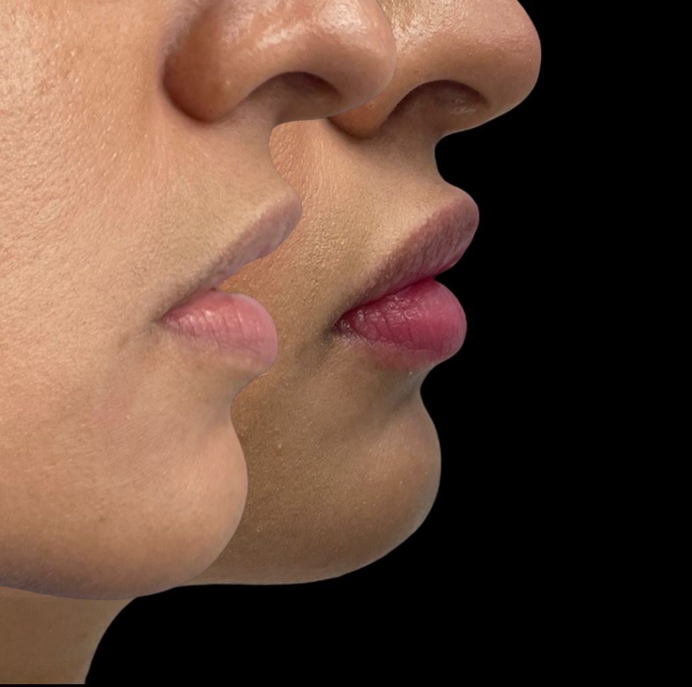 Jose Vicente Rocha Fernandez-46