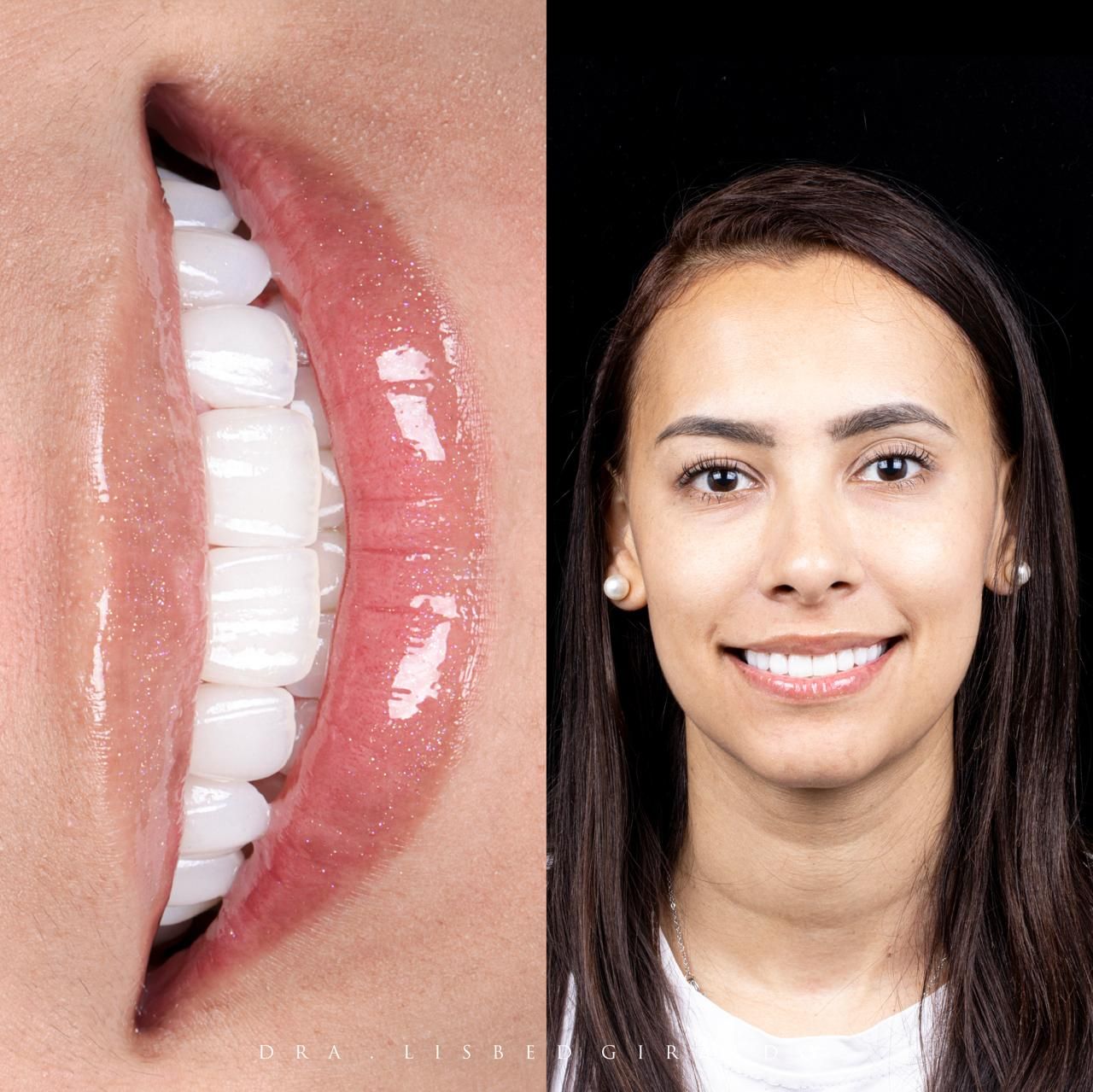 Lisbed Giraldo Olarte-44