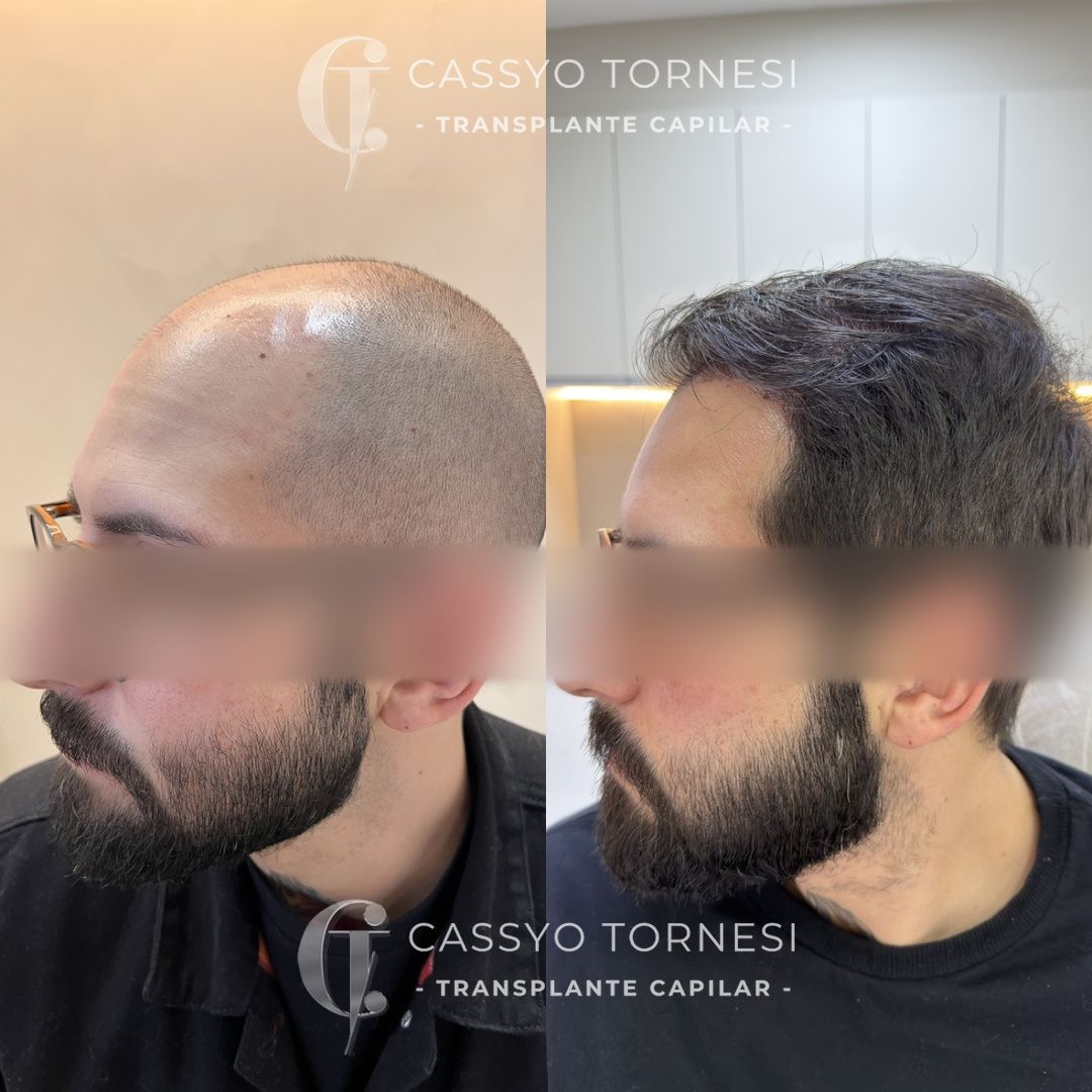 Cassyo Tornesi-29