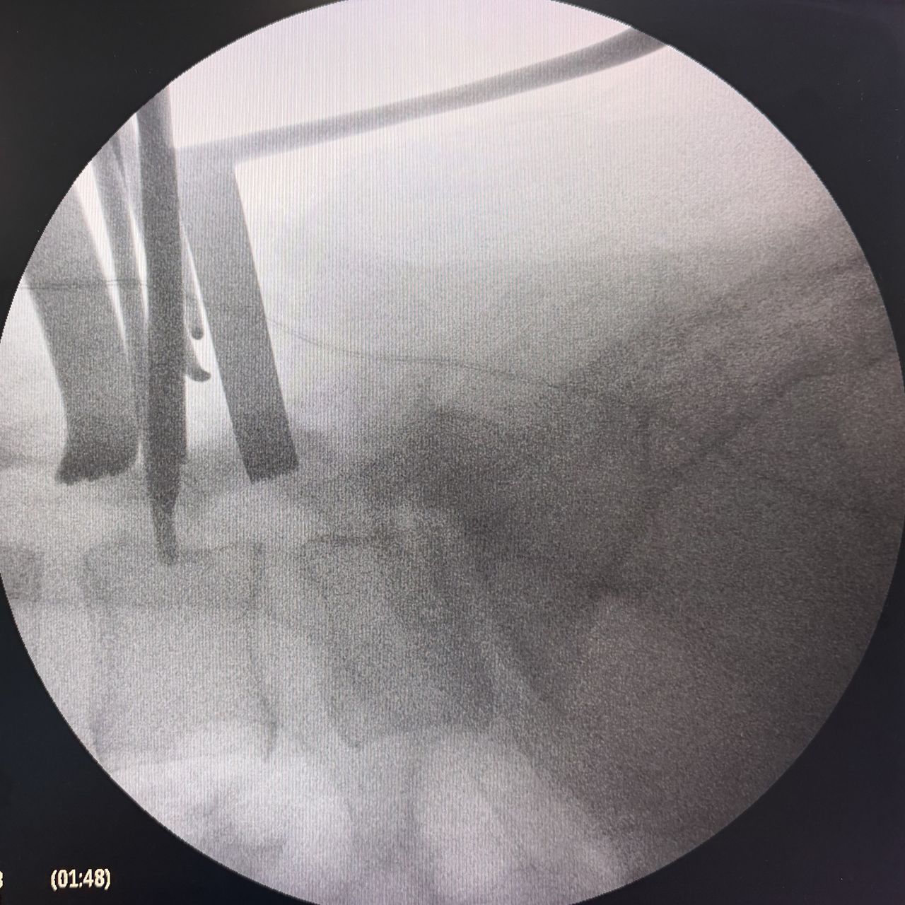 David Tafur Muñoz-2447