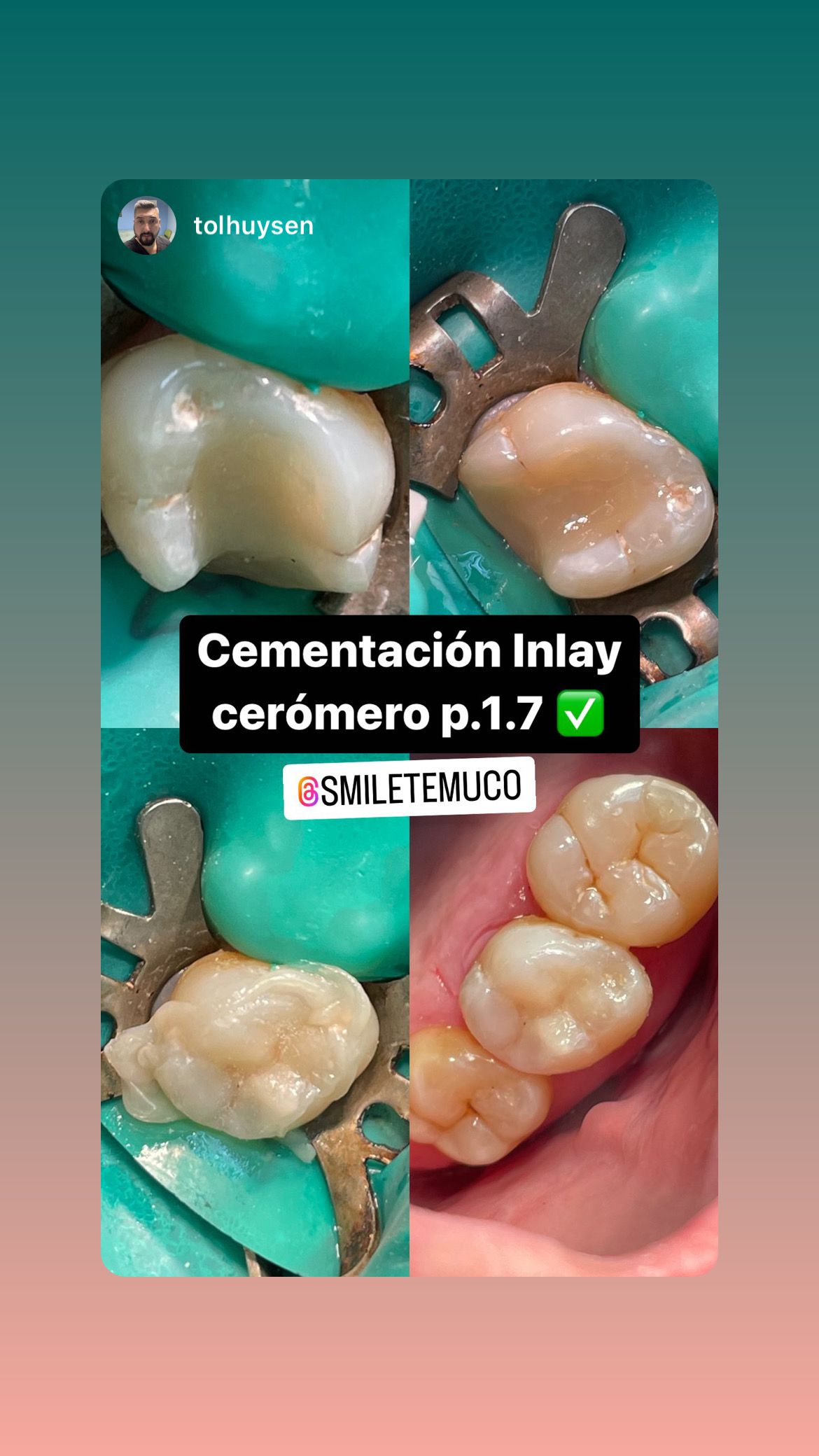 Luis Muñoz Tolhuysen-6