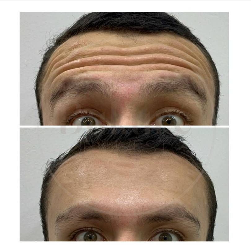 Oscar Iván Lozano Navarrete-9